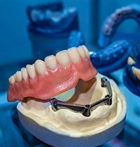 Dentures being crafted at lab