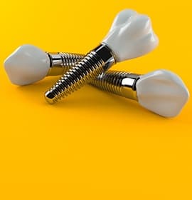 three dental implants