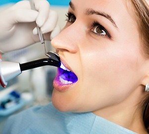woman receiving direct bonding from her dentist