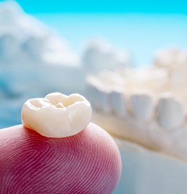 Close up of a dental crown resting on a fingertip