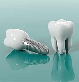 dentist pointing to model of dental implants in Brampton