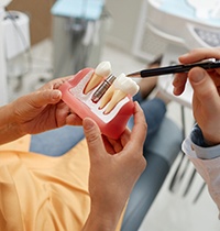 Dentist pointing to model of dental implant