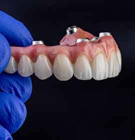 A gloved hand holding up an implant denture
