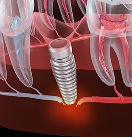 Senior male dental patient lying back in chair