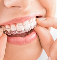 Nose-to-chin closeup of woman removing Invisalign from top arch