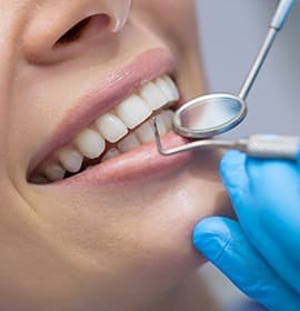 Closeup of smile with healthy teeth and gums