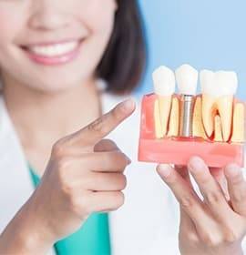 How dental implants work in Brampton 