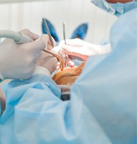 Dental implant surgery in Brampton 