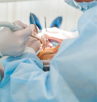 Dental implant surgery in Brampton