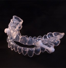 Close-up of oral appliance for sleep apnea in Brampton, ON