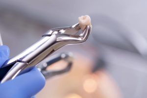 tooth being held in tooth extraction tool