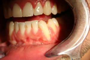 Patient's gums being examined
