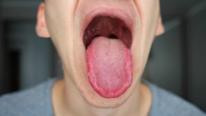 Man sticking out tongue