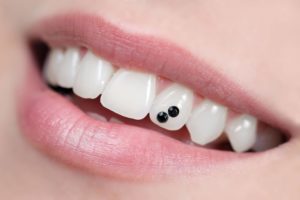 tooth jewels