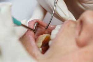 Dentist examining patient's gums