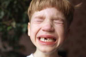 little boy upset after losing tooth