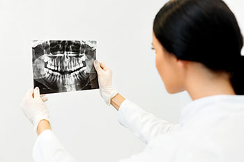 do i need dental xrays brampton dentist